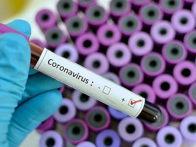 Coronavirus, agronegocios y estado de excepción