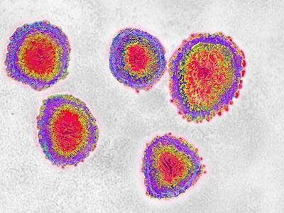 Una epidemia de motivos causó la expansión del Coronavirus en el mundo