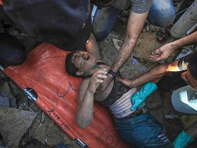 Un niño herido por los bombardeos es atendido por sanitarios en Gaza, el 12 de noviembre de 2023. / Mohammed Zannoun