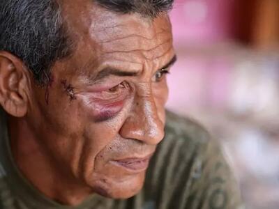 "Nunca pensé que me iban a atacar a mí": los sobrevivientes del ataque con misil al Bloque 12